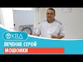 ✅ Лечение серой мошонки. Клинический случай №727