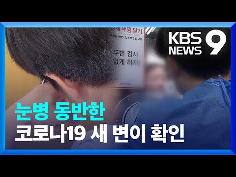 눈병 동반한 코로나19 새 변이 확산 9시 뉴스 KBS 2023 04 26 