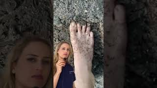 Doctor reacts: stepping on an anthill screenshot 2