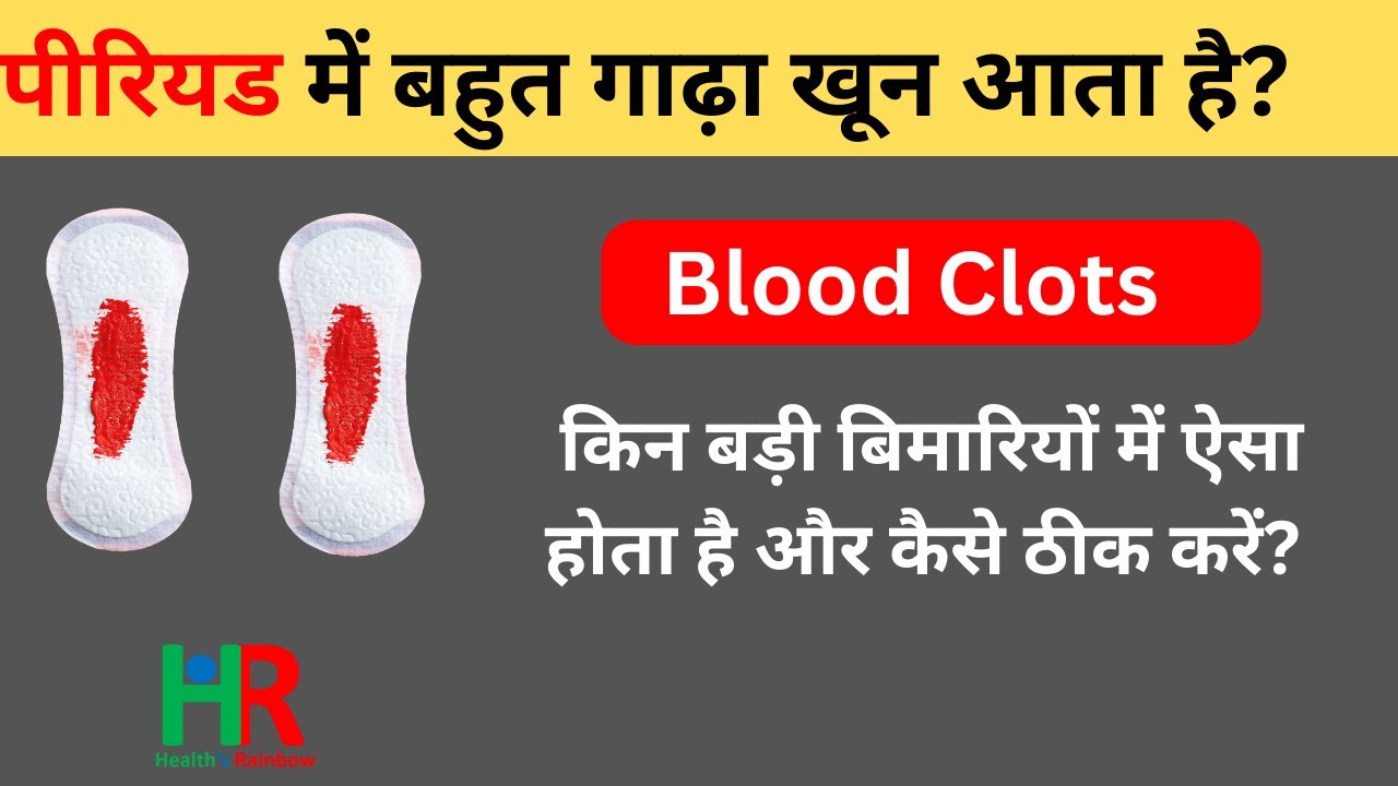 पीरियड में खून के थक्के Normal या Abnormal कब और क्यों होते हैं Blood clots during period