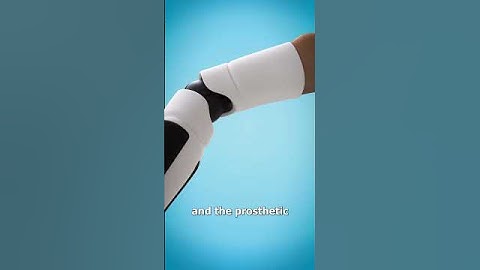 How A Bionic Arm Works 🤔