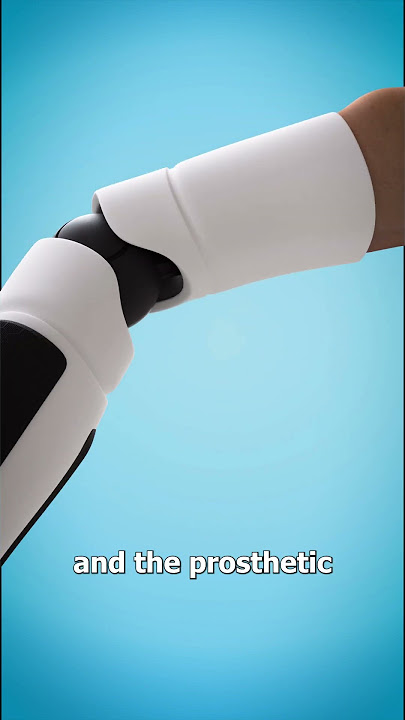 How A Bionic Arm Works 🤔