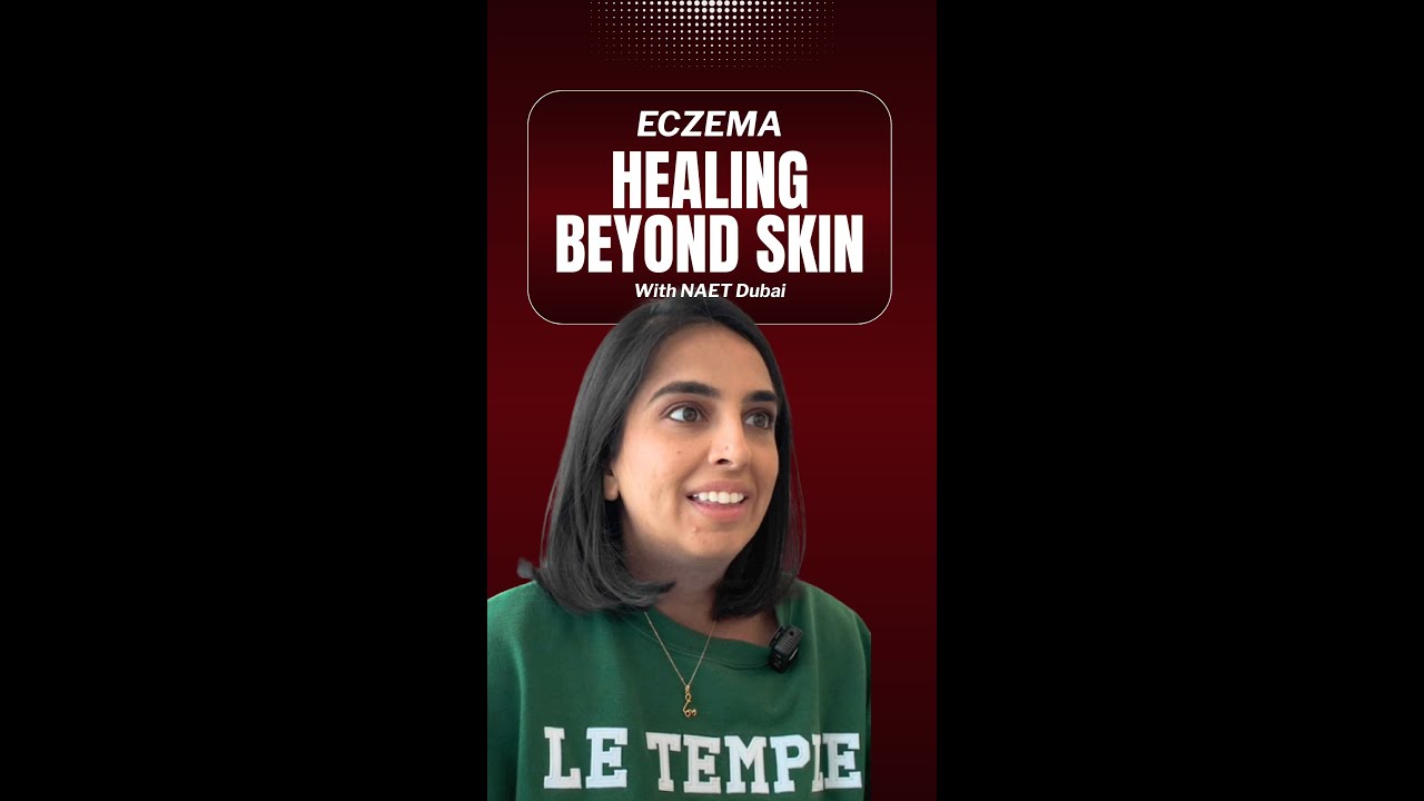 “Eczema - Unbelievable transformation with NAET Dubai”