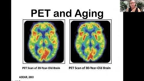 Positive Approach to Dementia Care Series #1: Normal vs Not Normal Aging