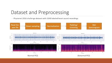 GR 325 - Early Heart Disease Detection Using Mel-Spectrograms and Deep Learning
