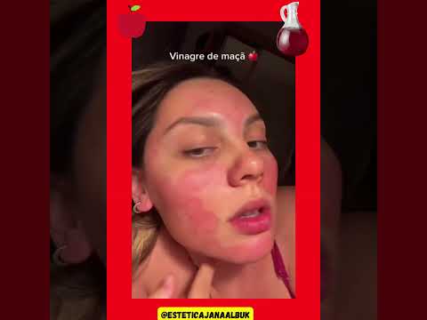 Torrei a cara!