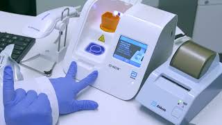 Redefining Strep A Management: The MAPflow and Abbott ID NOW™ Integration