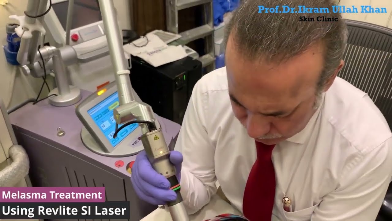 Melasma Blues? Revlite SI Laser Might Be Your LIFESAVER 