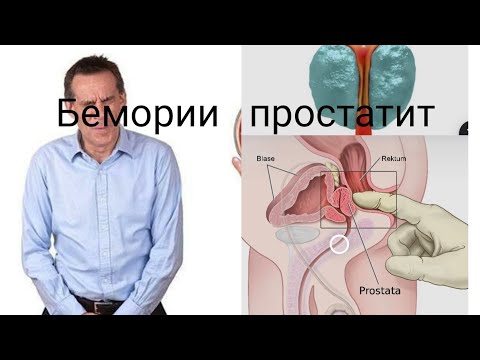 Бемории простатит шадид ва музмин.