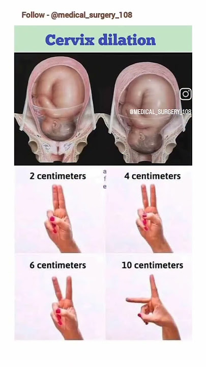 vaginal examination ( finger method)