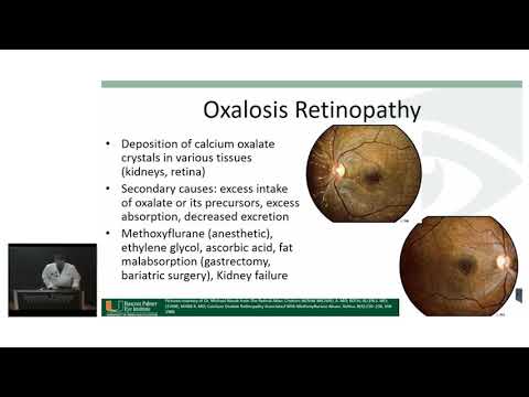 Bascom Palmer Grand Rounds - Dot and Fleck Retinopathy Secondary to Alport Syndrome