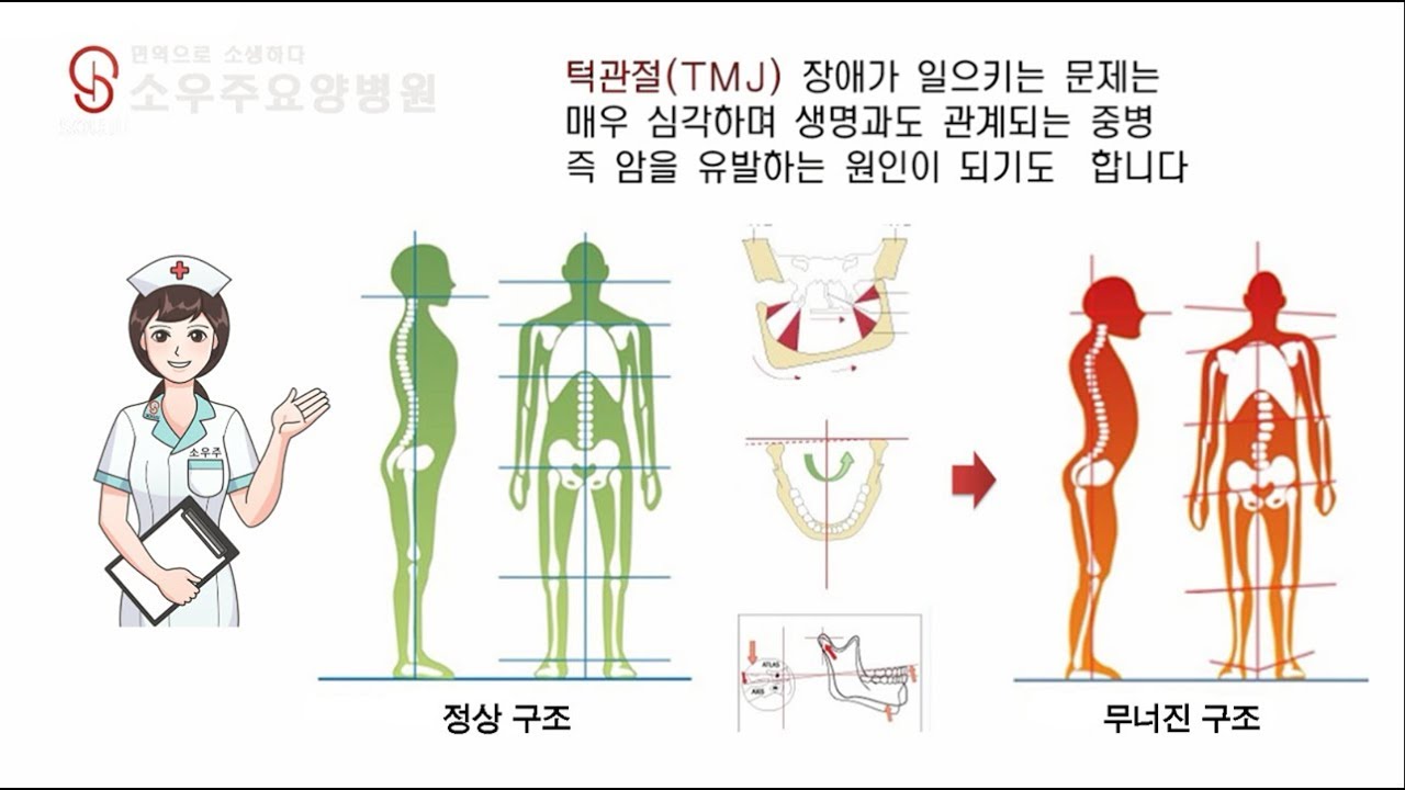 턱관절과 암 - YouTube