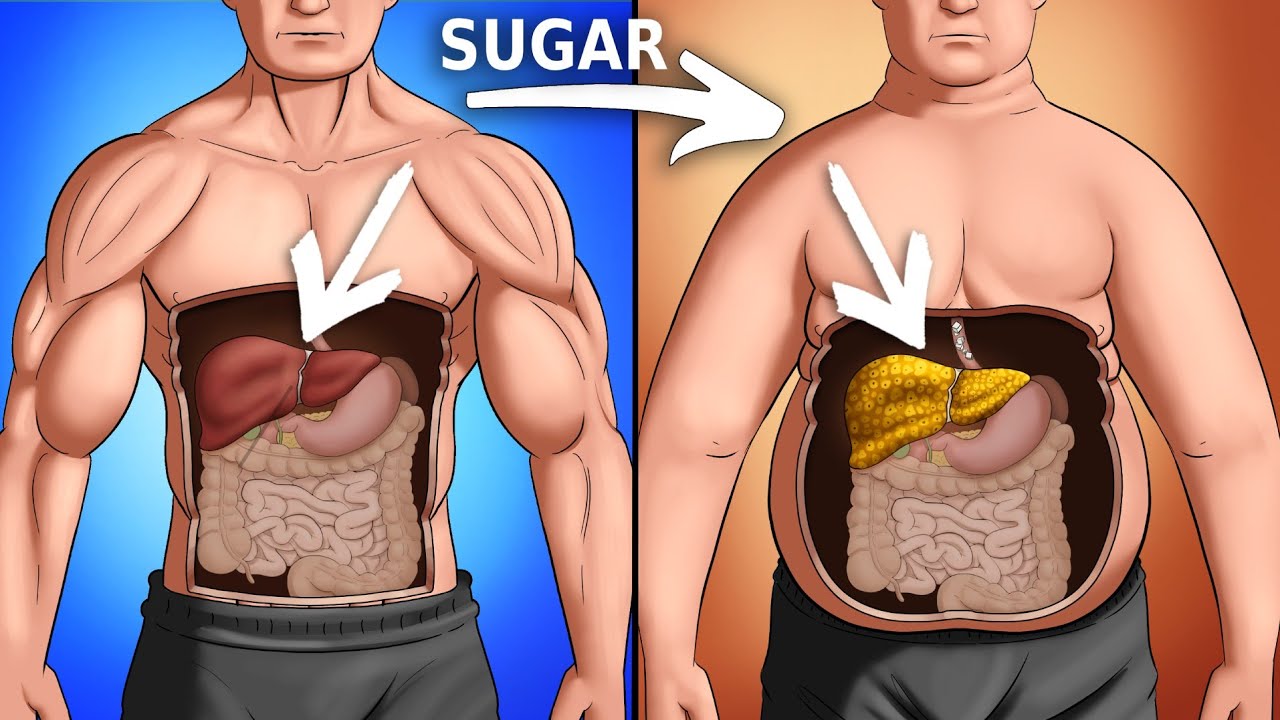 What Sugar Does To Your Body (Science-Based)