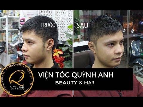 đầu tóc nam đẹp tại Kemtrinam.vn
