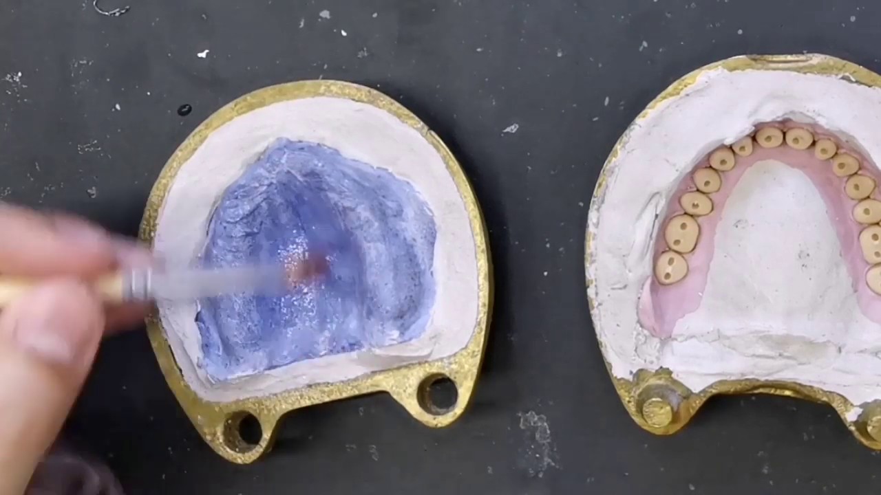 Malla de refuerzo en prostodoncia