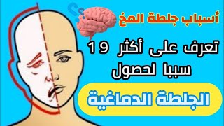 أسباب الجلطة الدماغية المفاجئة تعرف على جميع اسباب الجلطة الدماغية عند الرجال والنساء