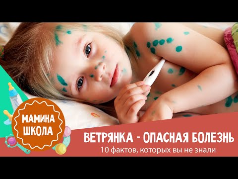 Ветрянка стала опасной болезнью