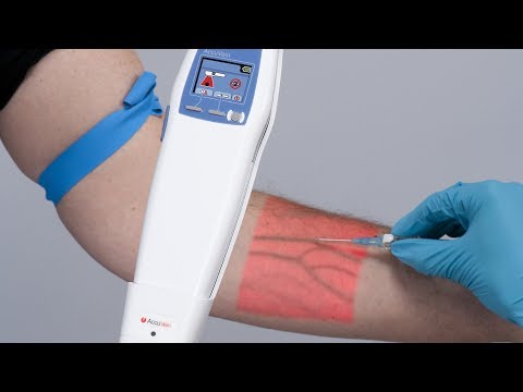 شاهد جهاز للكشف عن الأوردة بوضوح أثناء التحاليل