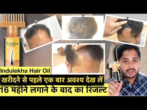 16-महीने-indulekha-hair-oil-use-करने-के-बाद-का-result-।-indulekha-hair-oil-review.