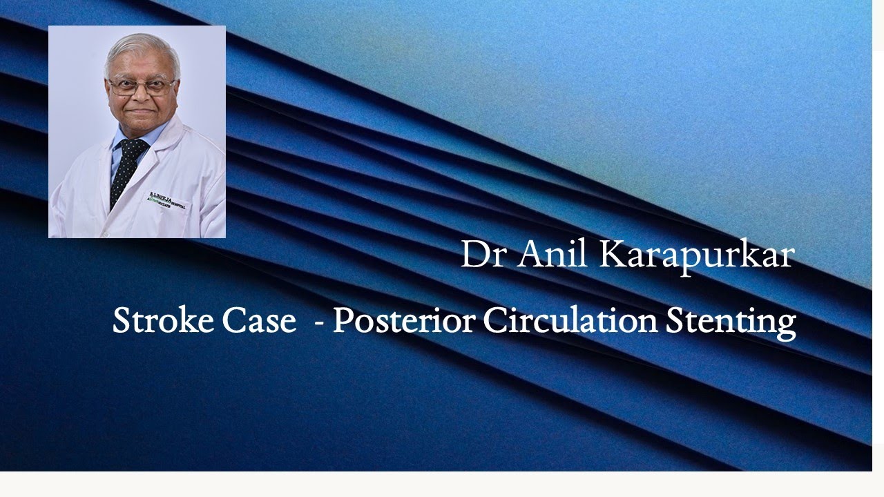 Posterior Circulation Stenting    Dr Anil Karapurkar