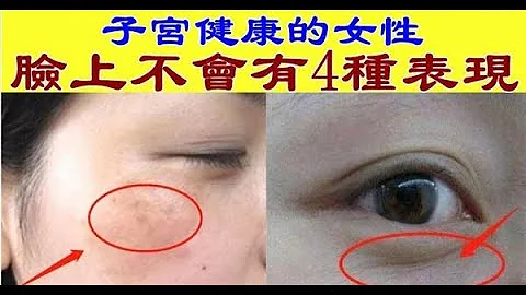 子宫健康的女性，脸上不会有4种表现，常喝1种水，子宫更光滑 - 天天要闻