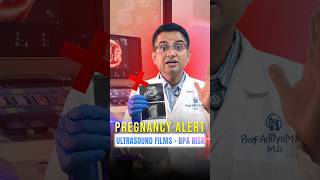Shocking Truth About Ultrasound Prints During Pregnancy ⚠️ (BPA Risk!)