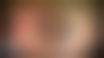 CataractCoach 1068: sutured capsular tension segment for lens coloboma