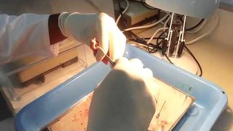 Spinal cord Extraction from Wistar Rat