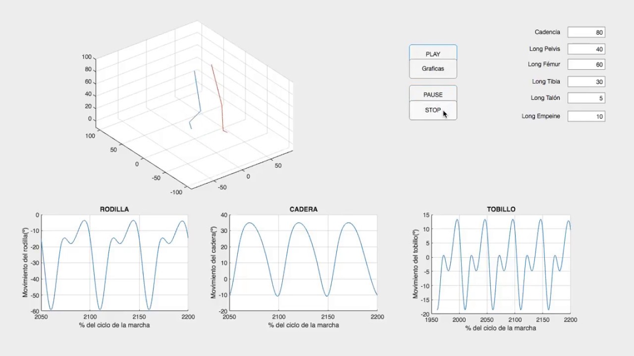 2º Vídeo Proyecto Ingeniería Biomédica 1, UEM camera iphone 8 plus apk