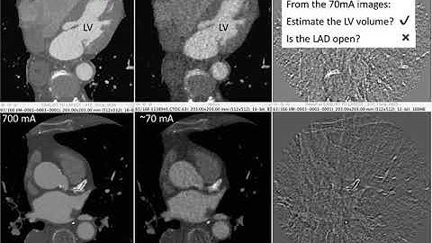 BENG280C Lecture 4 Image Quality