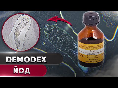 Йод против клеща | Угревая Железница Demodex