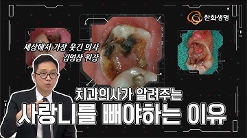 [건강톡] 사랑니 뽑지 않고 쓸 수는 없나요? - 강남레옹치과 김영삼 원장 -