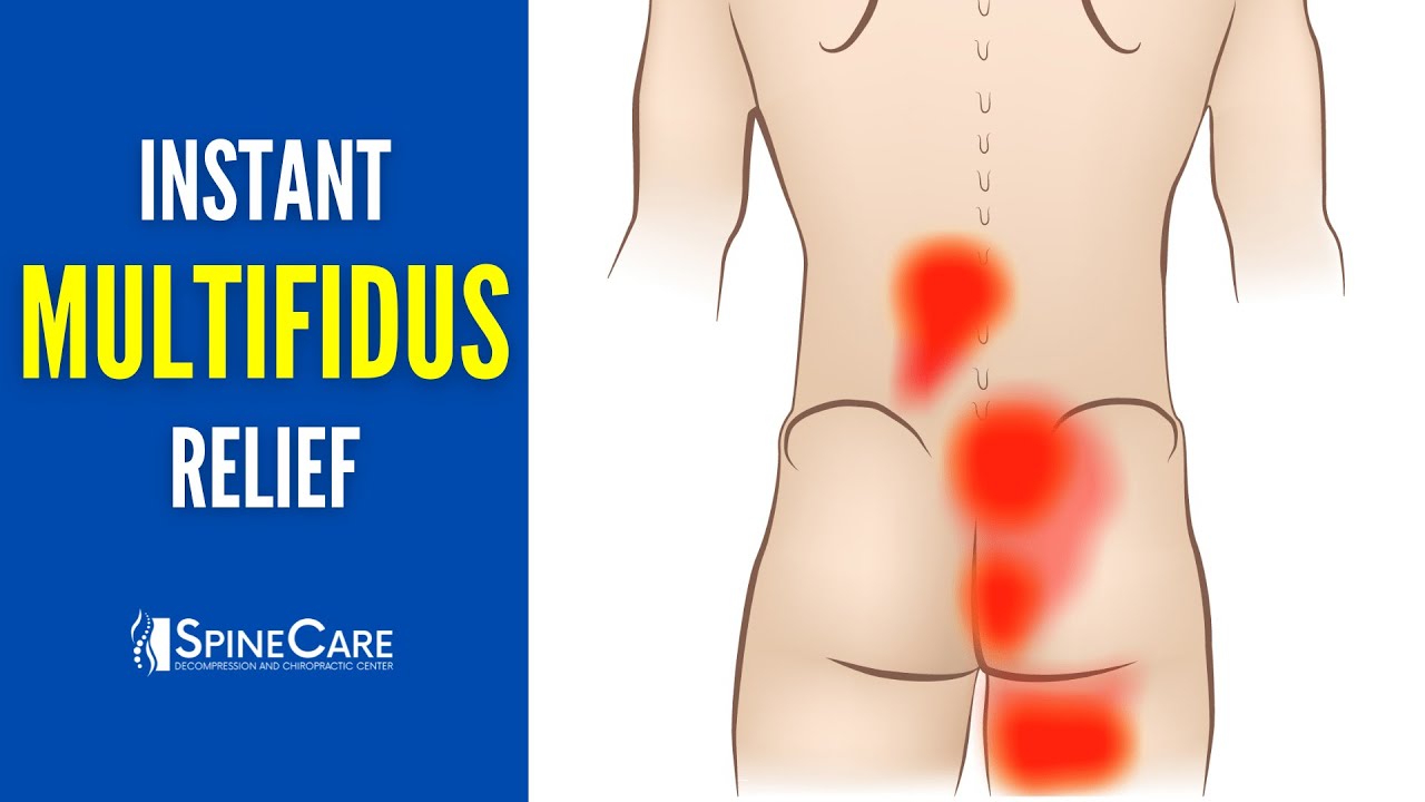 How to Instantly Relieve Multifidus Muscle Pain (STEP-BY-STEP GUIDE)
