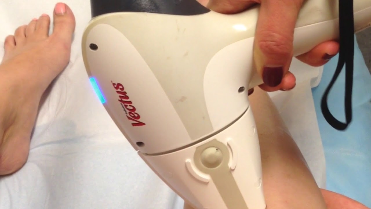 Vectus laser hair removal near me Outlet