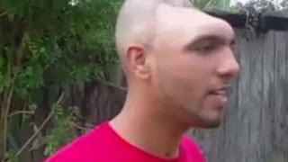 動画 ドラッグはダメ 頭が半分しかない男 がインタビューでメッセージ 付録部 Blog Bu