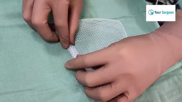 Best Mesh for Inguinal Hernia ?