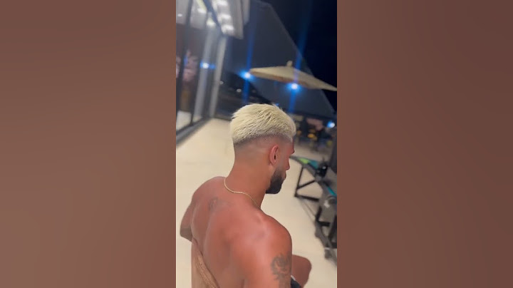 E O NOVO VISUAL DO YURI ALBERTO?