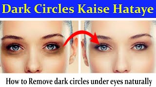 Dark Circles Kaise Hataye | How to Remove dark circles under eyes naturally in photoshop hindi/ urdu