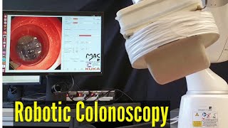 Using robotic assistance to make colonoscopy kinder and easier