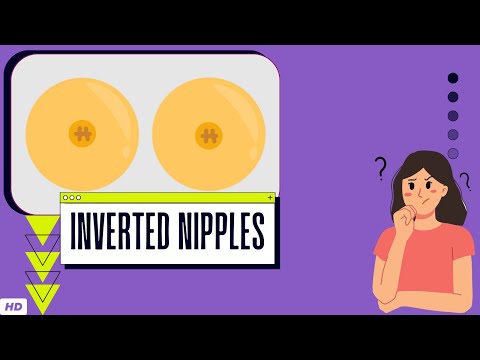 Inverted Nipples: Everything You Need To Know