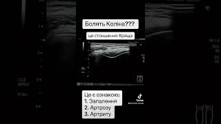 Біль в коліні Причина болі в коліні Діагностика болі в коліні #shorts #шортс