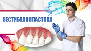 вестибулопластика