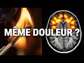Pourquoi une rupture fait-elle AUSSI MAL qu'une brûlure ? (La Science)