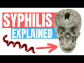 Do you have Syphilis? - Symptoms, Tips and Treatment - Doctor Explains