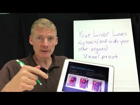 your-liver-loves-ketosis!-and-so-do-your-other-organs!-visual-proof.