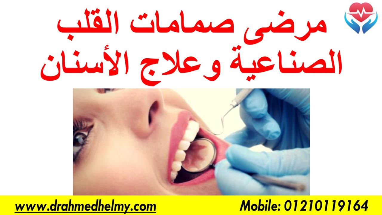 مرضى صمامات القلب الصناعية وعلاج الأسنان