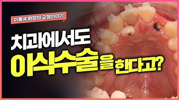 치과에서도 이식수술을?  자가치아이식 에 대해 알아보겠습니다.
