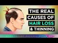 The real causes of hair loss