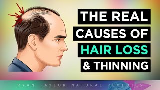 The REAL Causes of HAIR LOSS