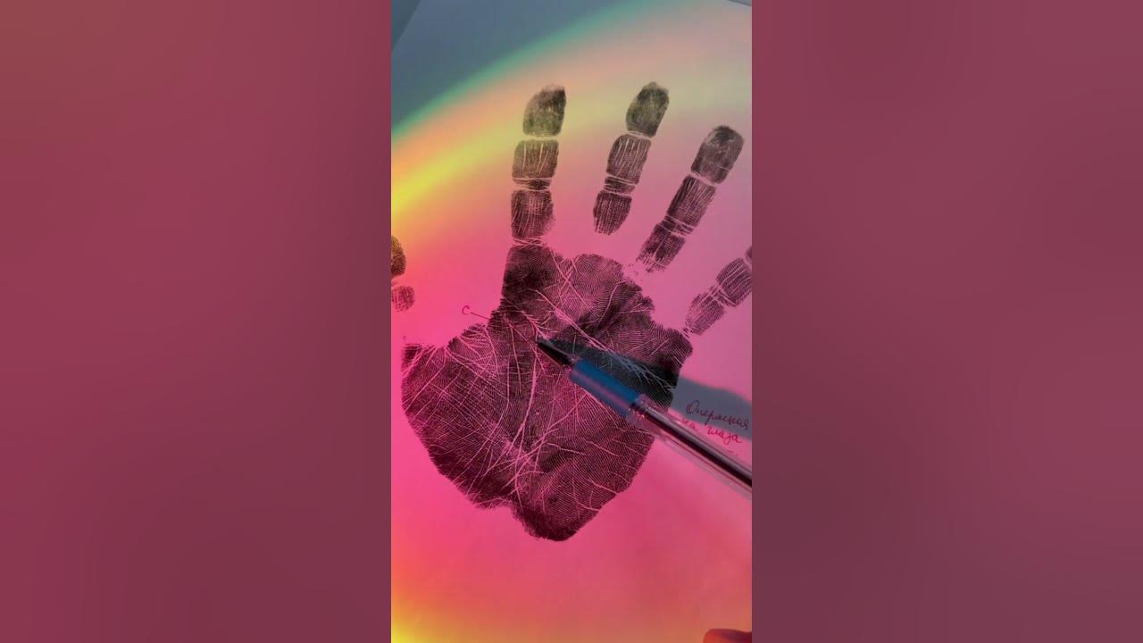 ️ Операция на руке - YouTube